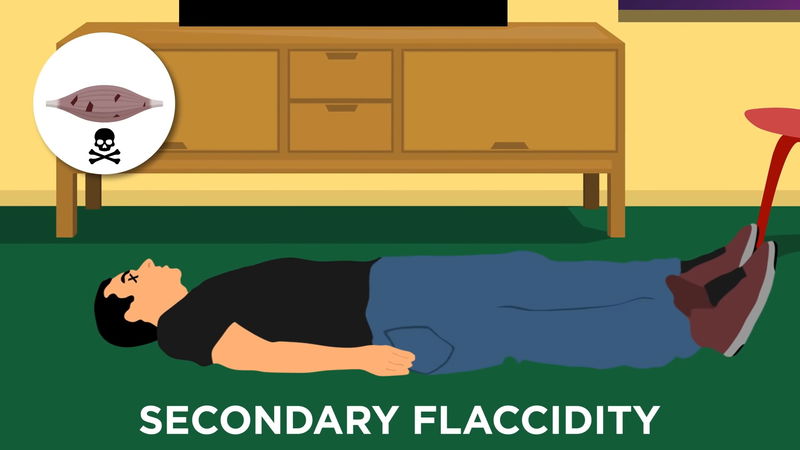 seondary_flaccidity