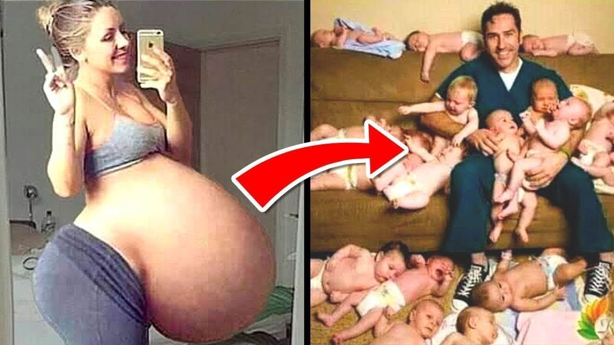 Most Bizarre Pregnancy Cases