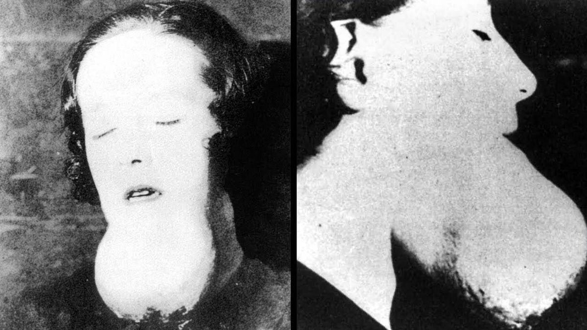 The Terrifying Story Of The Radium Girls