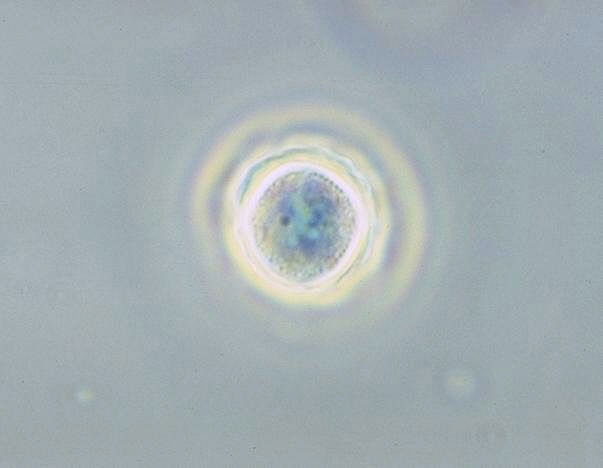 Acanthamoeba