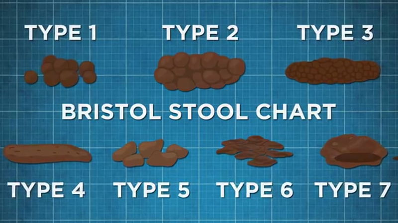 Bristol stool chart