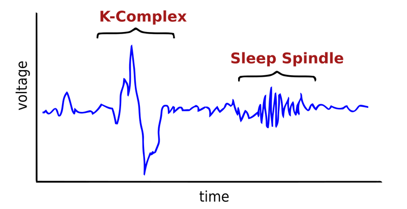 sleep spindle