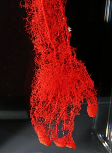 Blood_Vessels_in_a_Human_